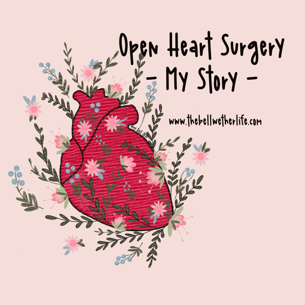 My Open Heart Surgery Story